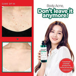 Some by Mi Acne Clear Body Cleanser, nettoyant corps a l'arbre a the pour peau acneique
