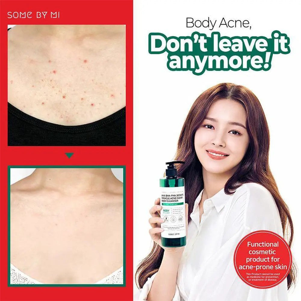 Some by Mi Acne Clear Body Cleanser, nettoyant corps a l'arbre a the pour peau acneique