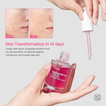 Anua Niacinamide 10%+ TXA 4% Serum, sérum pour estomper les marques post-acné