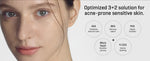 Some by Mi 30 Days Miracle Cream, soin coreen aux triple acides pour peau irritee