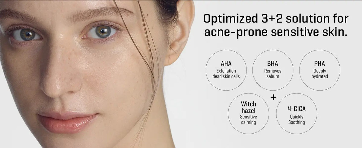 Some by Mi 30 Days Miracle Cream, soin coreen aux triple acides pour peau irritee