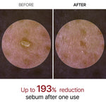 Dr. Melaxin Peel Shot White Rice Ampoule, ampoule exfoliante coréenne qui affine la texture